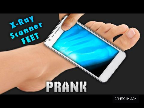 Simulator X-Ray Feet - Game Overview & History