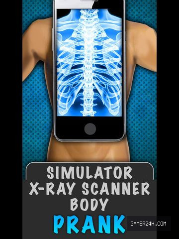 Simulator X-Ray Body - Game Overview & History